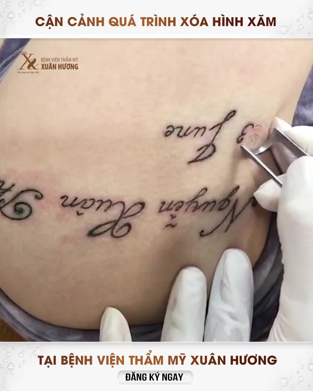 HÌNH XĂM NHỎ NHƯNG MỰC IN SÂU DƯỚI DA - DỄ XÓA XĂM NHƯNG KHÔNG PHẢI Ở ĐÂU CŨNG LÀM ĐƯỢC