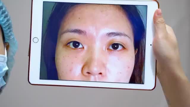 "Hô biến" mắt lệch to nhỏ trở nên đều đẹp ấn tượng giúp đôi mắt khách hàng trẻ trung rạng rỡ ngay tức thì