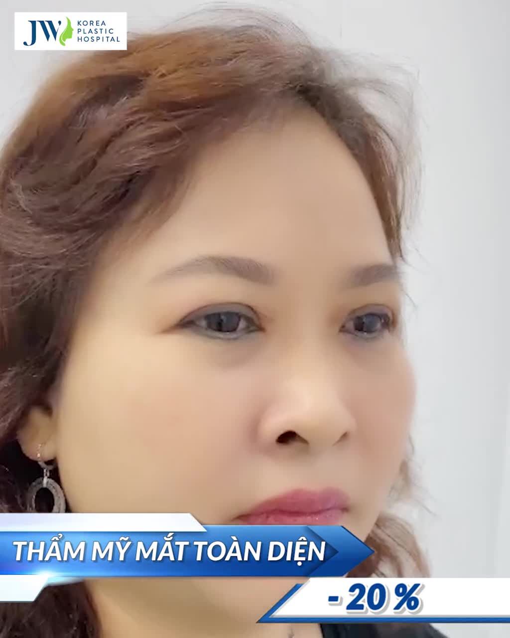 HỒI XUÂN ĐÔI MẮT U SẦU - TẠM BIỆT NỖI BUỒN LÃO HOÁ