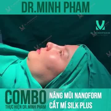 KẾT QUẢ COMBO NÂNG MŨI NANOFORM + CẮT MÍ SILK PLUS