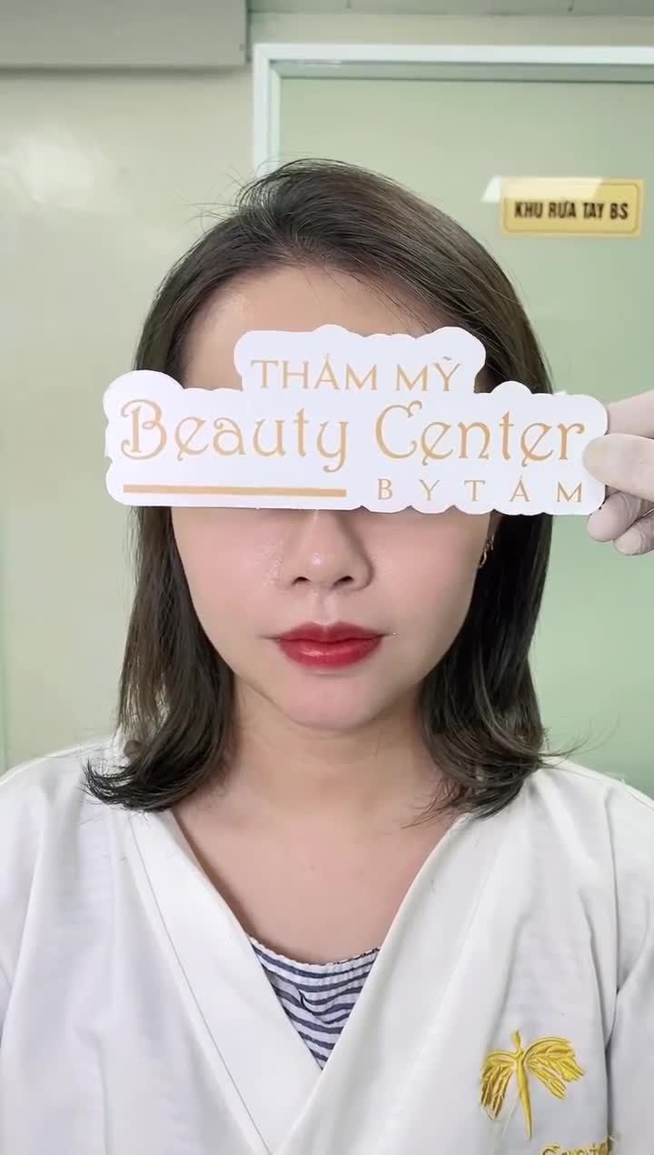 Khách hàng dịch vụ Filler Cằm và liệu trình 2 của Tan mỡ nọng cằm.