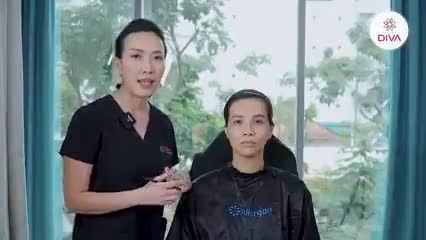 KHÓE MŨI MIỆNG SÂU, PHƯƠNG PHÁP NÀO ĐIỀU TRỊ HIỆU QUẢ?