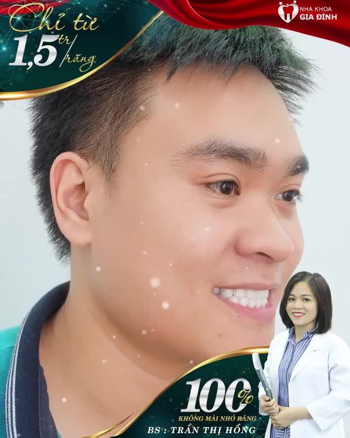 LÀM RĂNG THẨM MỸ - CHI PHÍ CỰC RẺ TẠI NHA KHOA GIA ĐÌNH