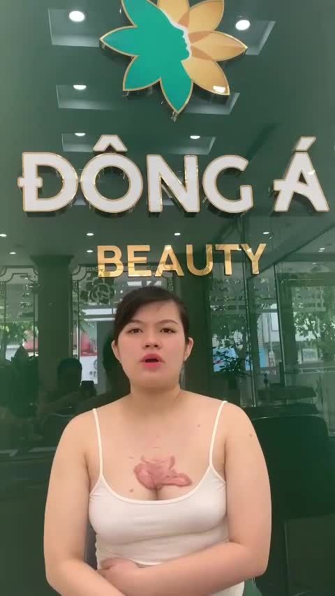 LẮNG NGHE CHIA SẺ CỦA CHỊ KHÁCH HÀNG BỊ "BIẾN CHỨNG" SẸO LỒI