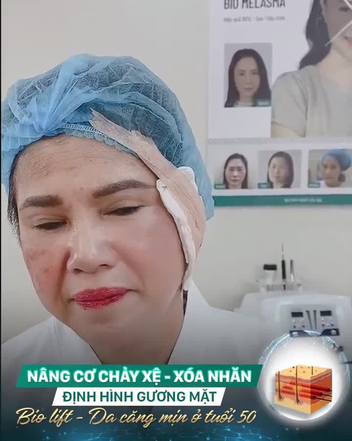 "LÃO HÓA NGƯỢC" VỚI CĂNG CHỈ BIO LIFT