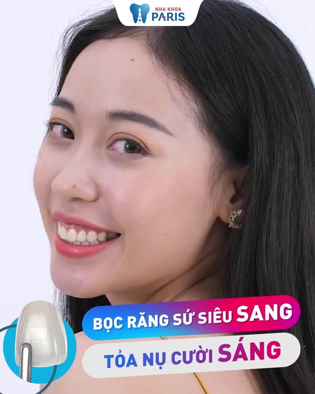 Lễ Tân Khách Sạn 5 Sao - Thay Đổi Để Tự Tin