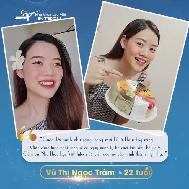 "LỘT XÁC" NHAN SẮC SAU QUÁ TRÌNH NIỀNG RĂNG KHẤP KHỂNH
