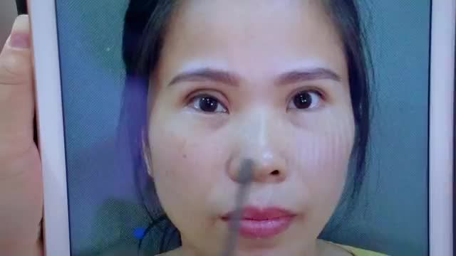 Lý do vì sao làm mí tiểu phẫu nhỏ những dễ biến chứng hỏng? Theo dõi tại video này để tìm hiểu thêm bạn nhé