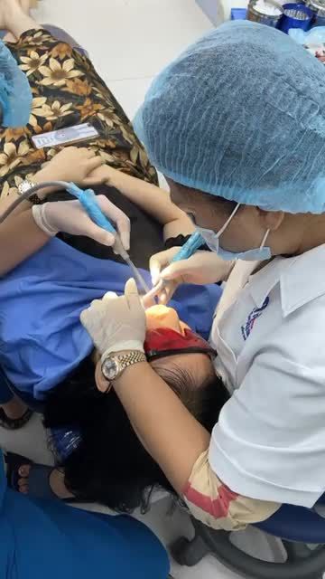 Mài 20 răng để bọc sứ cho khách hàng tại Kim Mã