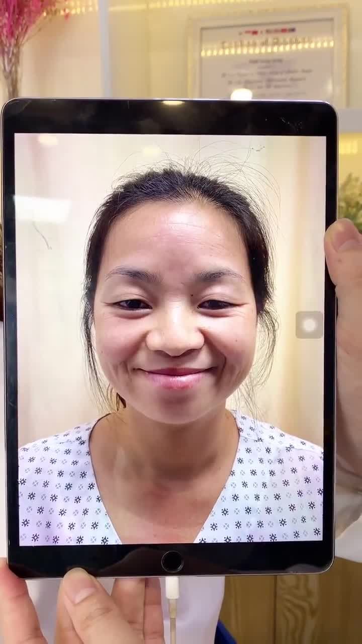 MẮT 4 IN 1 TẠI DR.PARK CÓ THẬT SỰ ĐẸP NHƯ LỜI ĐỒN?