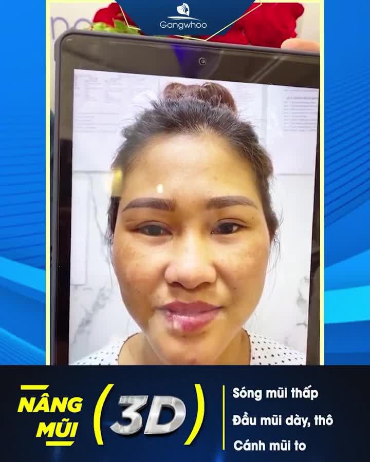 MŨI 3D LÀ NHƯ THẾ NÀO? CÓ TỐT KHÔNG