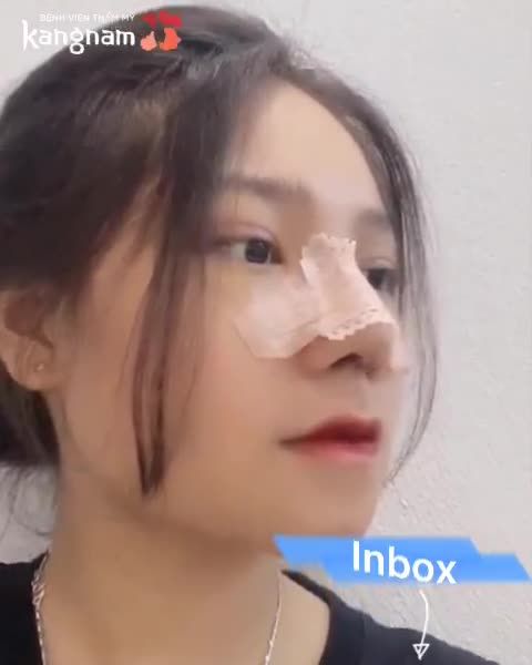 MŨI 7 NGÀY Lên form chuẩn như này đã yêu chưa ạ