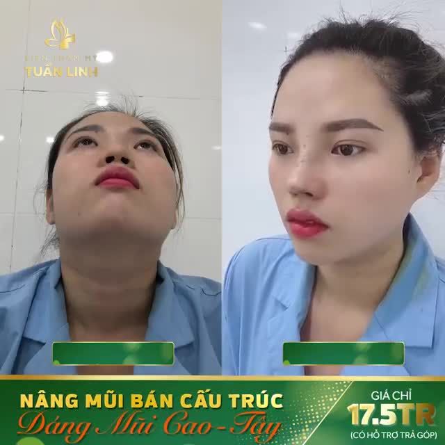 MŨI QUYẾT ĐỊNH 80 % NHAN SẮC...!