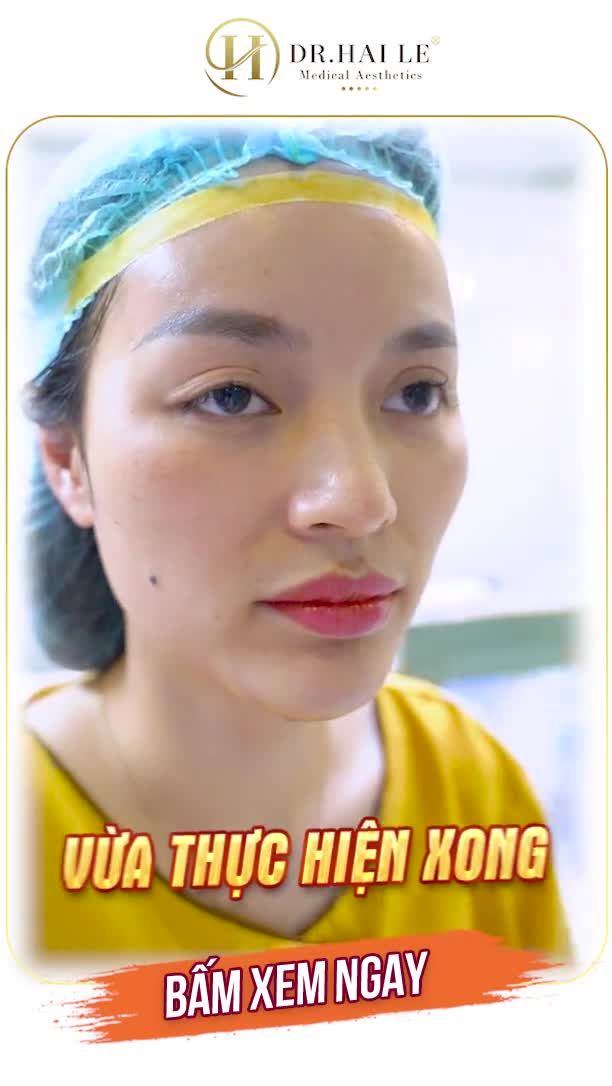 Nàng ấy từng nói, trước khi tới Dr.Hải Lê, mỗi lần chụp ảnh là phải cà qua 7749 lần app chỉ để chỉnh mỗi cái cằm như ý
