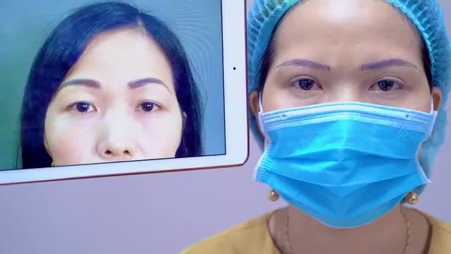Nâng cung mày giúp đôi mắt chị em phụ nữ ngoài 30++ trẻ trung rạng rỡ như thế nào? Mời quý khách hàng cùng đón xem