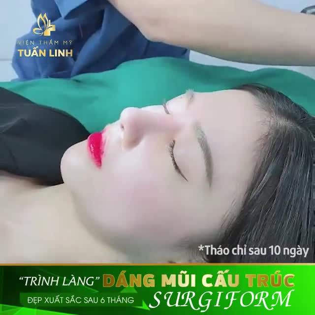 NÂNG MŨI CẤU TRÚC SỤN SURGIFORM - LỰA CHỌN SỐ 1 CHO DÁNG MŨI ĐẸP HOÀN HẢO.