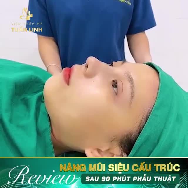 NÂNG MŨI SIÊU CẤU TRÚC SAU 90 PHÚT SẼ NHƯ THẾ NÀO