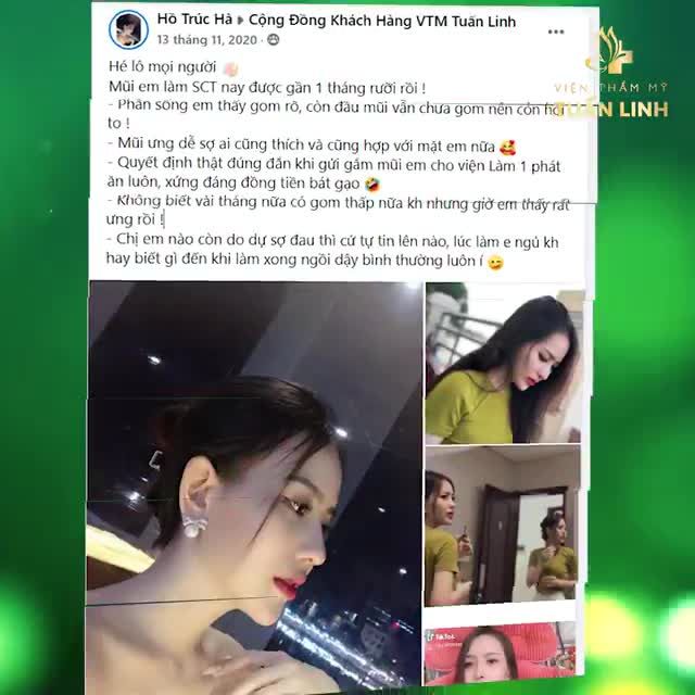 NHỮNG CHIA SẺ CỰC THẬT CỦA KHÁCH HÀNG SAU NÂNG MŨI TẠI TUẤN LINH.