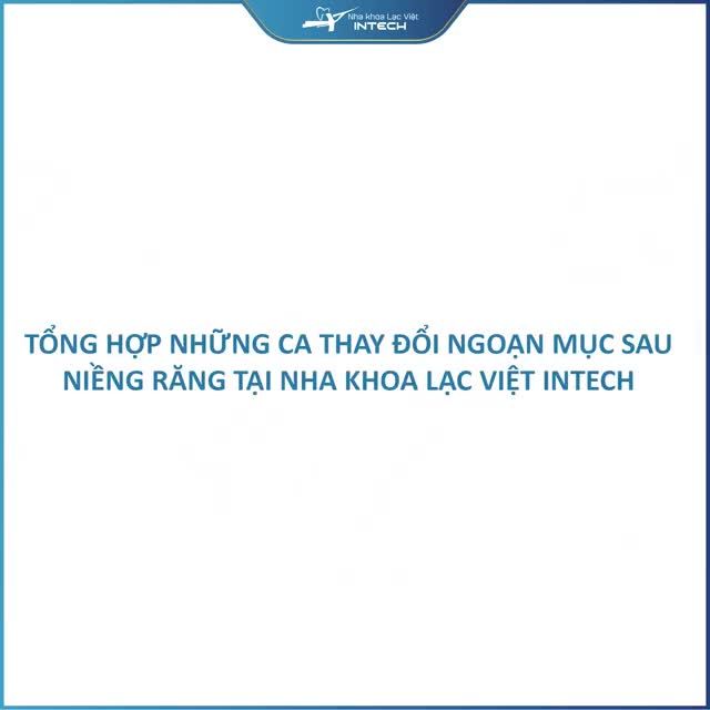 NHỮNG MÀN LỘT XÁC NGOẠN MỤC SAU NIỀNG RĂNG TẠI HỆ THỐNG NHA KHOA LẠC VIỆT INTECH