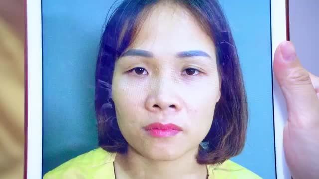 Niêm vui khi sở hữu đôi mắt 2 mí rõ nét sau hơn 30 năm sống chung cùng đôi mắt lệch to nhỏ