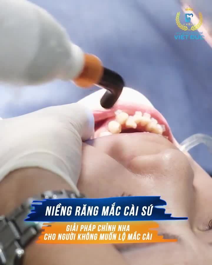 Niềng răng mắc cài sứ sẽ là một sự lựa chọn cực kỳ lý tưởng dành cho bạn trong suốt quá trình chỉnh nha.