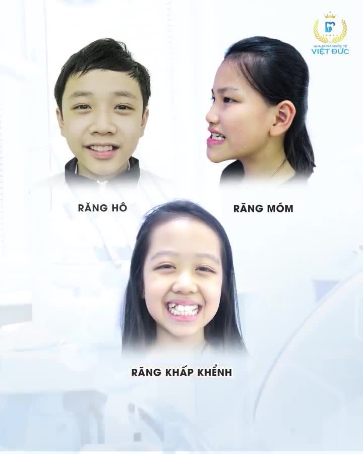 Niềng răng sớm cho con - Trao con cơ hội sớm - tạo tương lai sớm