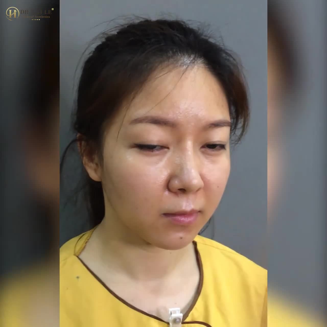 Phải xem những khách hàng đã trải nghiệm chia sẻ để có thêm động lực thực hiện các dịch vụ THẨM MỸ tại Dr.Hải Lê đấy ạ