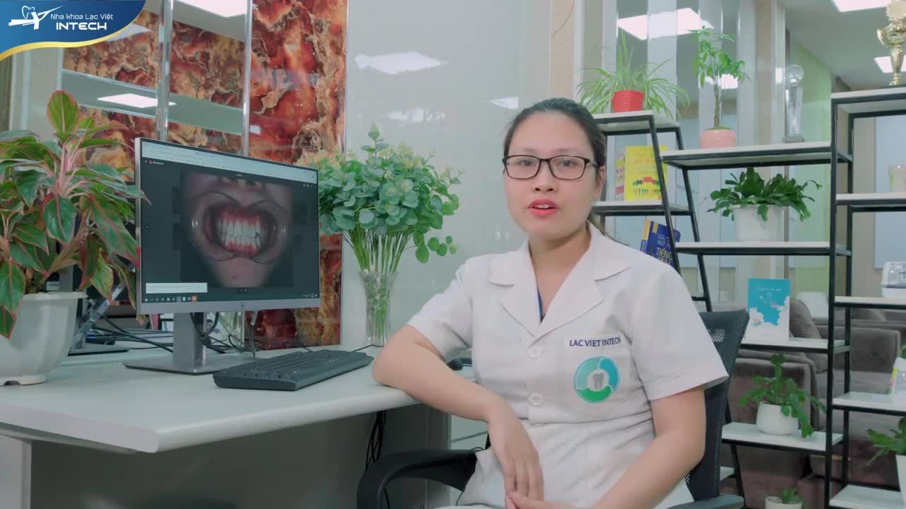 PHÂN TÍCH LÂM SÀNG CASE CHEN CHÚC, KHỚP CẮN ĐỐI ĐẦU - THÁO MẮC CÀI SAU 12 THÁNG ĐIỀU TRỊ