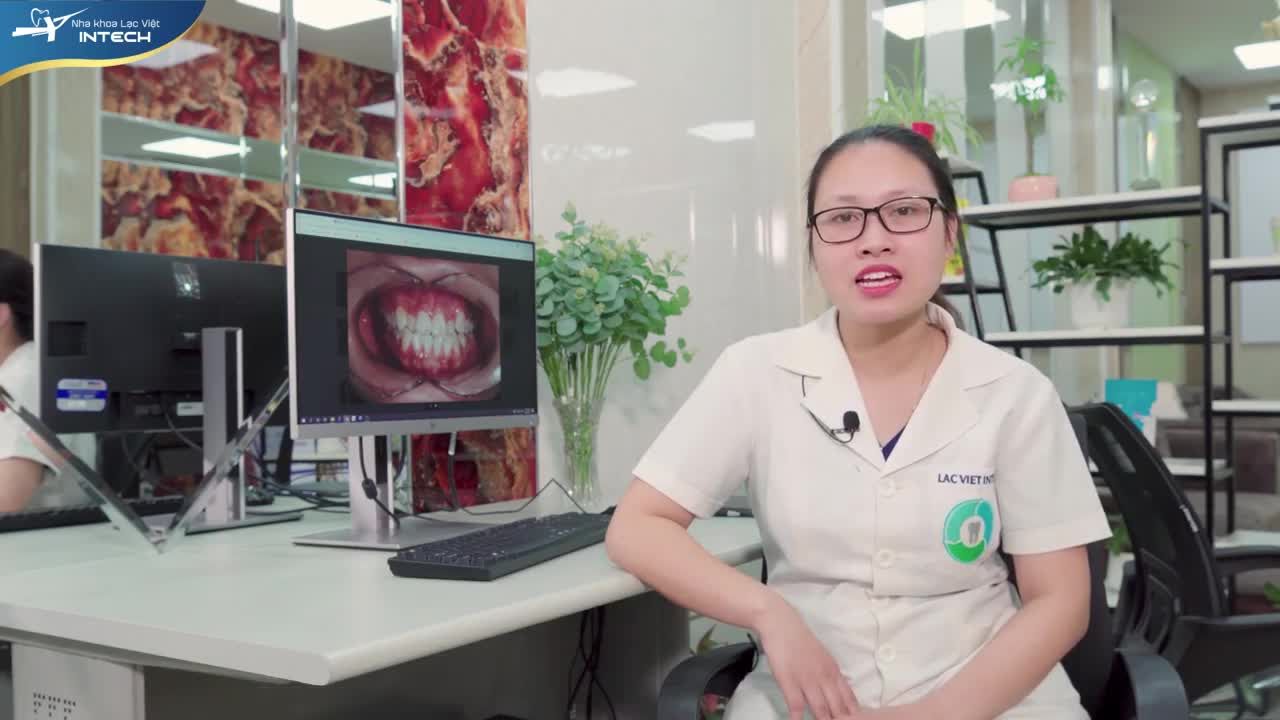 PHÂN TÍCH LÂM SÀNG CASE NIỀNG RĂNG CHEN CHÚC, KHỚP CẮN ĐỐI ĐẦU THAY ĐỔI SAU 13 THÁNG ĐIỀU TRỊ