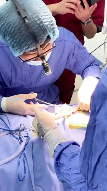 Quá trình bác sĩ Kangnam bóc tách sụn sườn trong phương pháp NÂNG MŨI SỤN SƯỜN