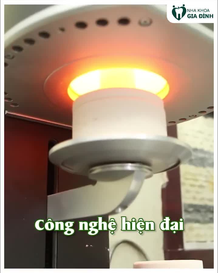 RĂNG SỨ SAGEMAX – VẺ ĐẸP THUẦN KHIẾT, BỀN BỈ DÒNG RĂNG CAO CẤP ĐƯỢC ƯA CHUỘNG NHẤT 2021
