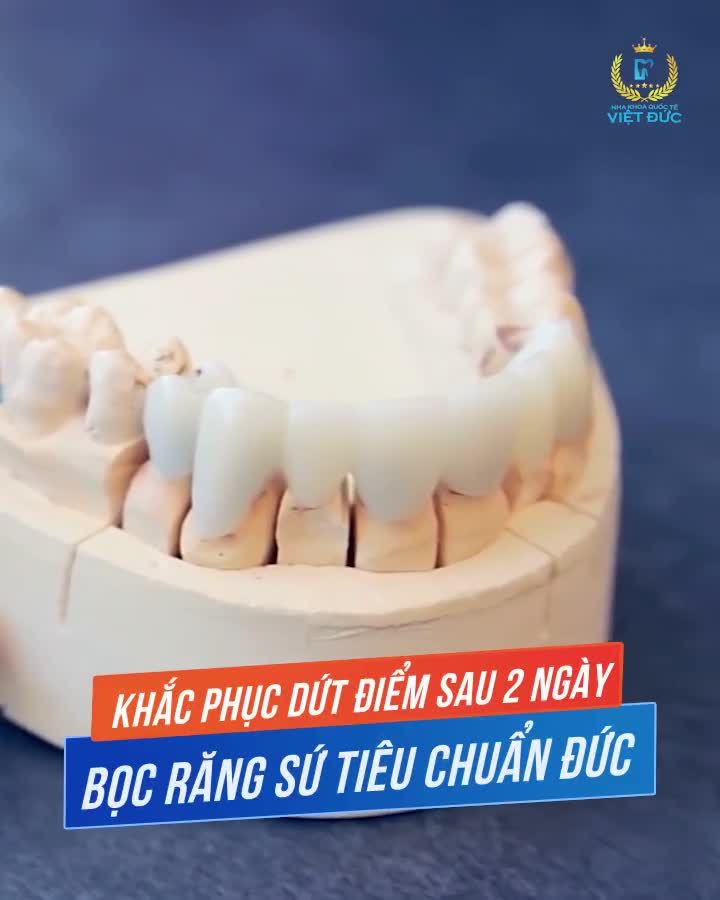 Răng Xấu  -  Nhiễm Màu - Ố Vàng -  MấtTự Tin