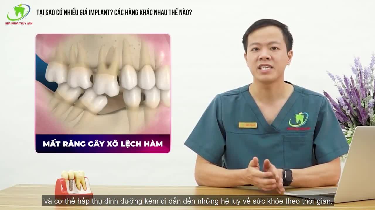 TẠI SAO IMPLANT CÓ NHIỀU LOẠI VÀ CÁC MỨC GIÁ KHÁC NHAU?
