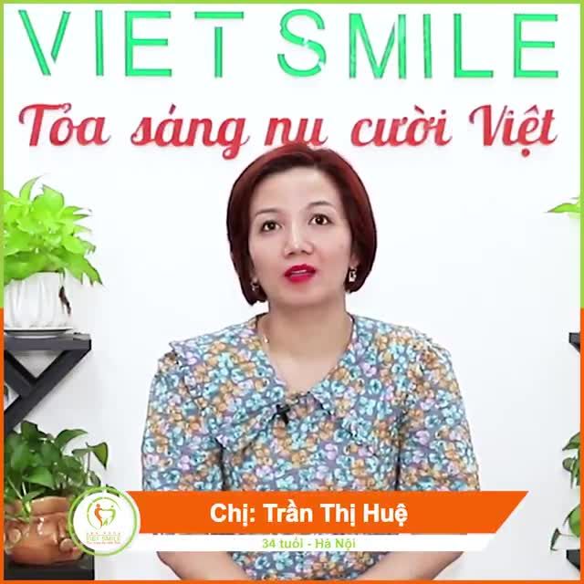 Tạm biệt răng ố vàng, không đều màu với răng sứ Nacera.