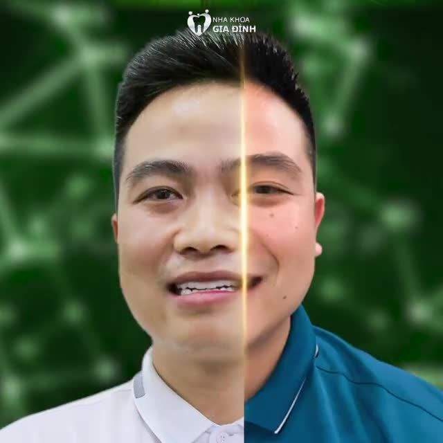 THẨM MỸ RĂNG SỨ - LẤY LẠI BẢN LĨNH PHÁI MẠNH
