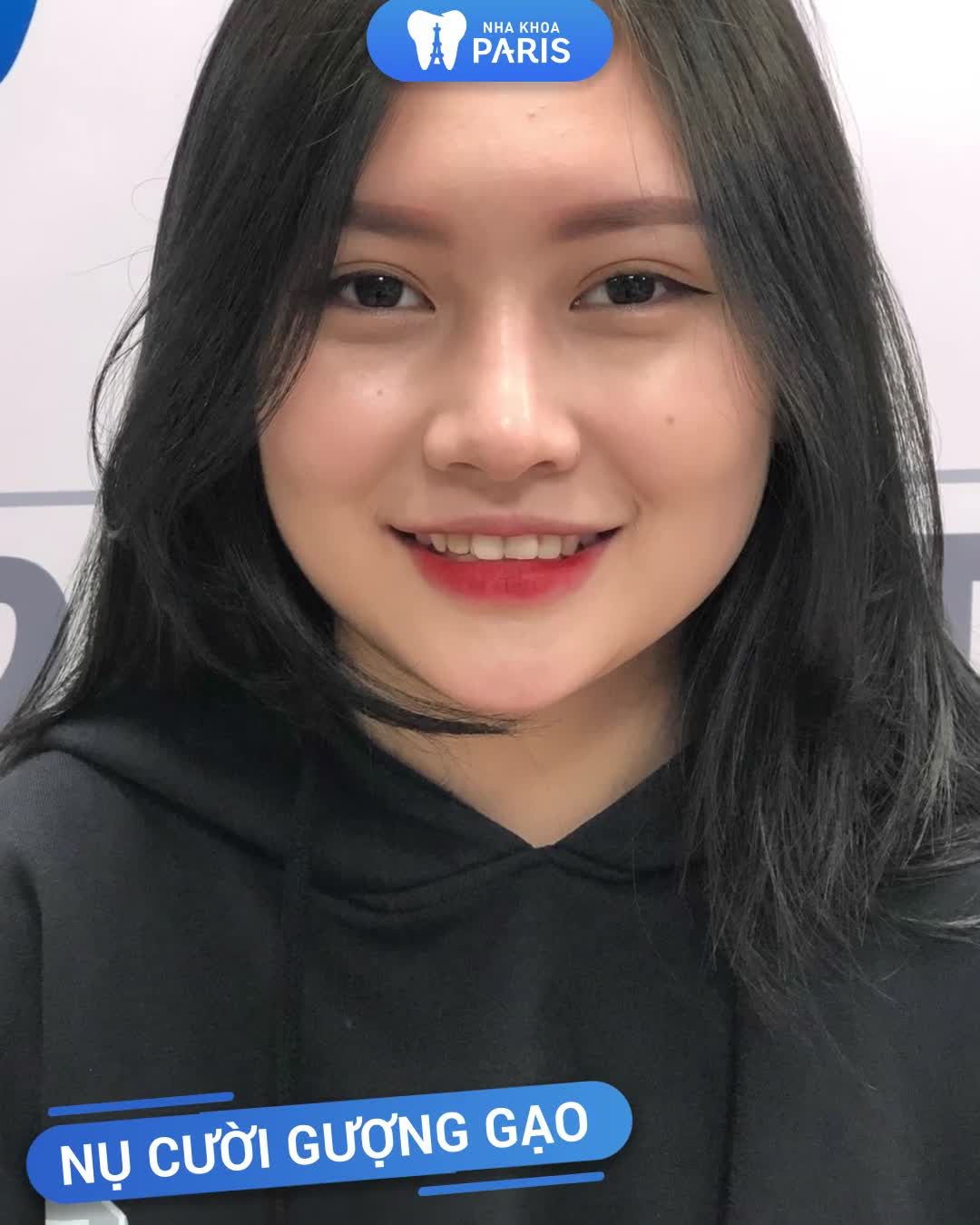 Thẩm Mỹ Răng Thẩm Mỹ Cả Khuôn Mặt