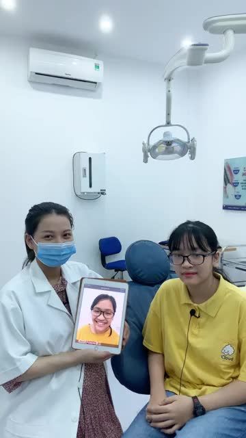 Tháo mắc cài cho KH huyền oanh 16t đến từ Nam Đàn Nghệ An sau 1,5 năm chỉnh nha