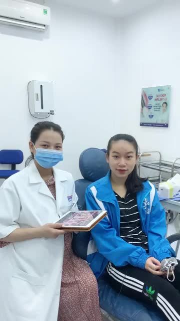 Thay đổi nụ cười sau 10 tháng chỉnh nha tại nha khoa PARIS Vinh