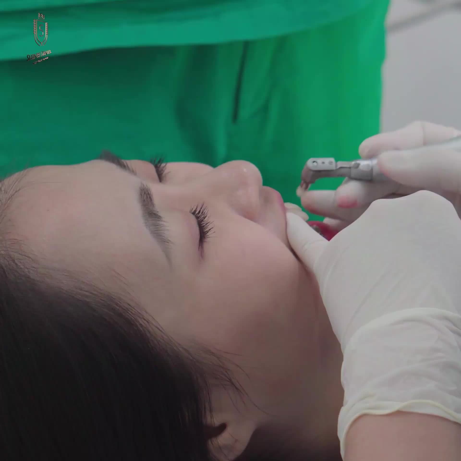 THAY ĐỔI NỤ CƯỜI - THAY ĐỔI HẠNH PHÚC