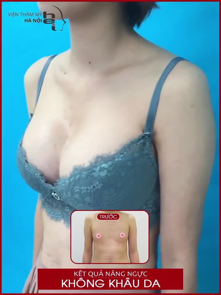 THOÁT KHỎI NỖI ÁM ẢNH "BỨC TƯỜNG" CHỈ SAU 60 PHÚT.