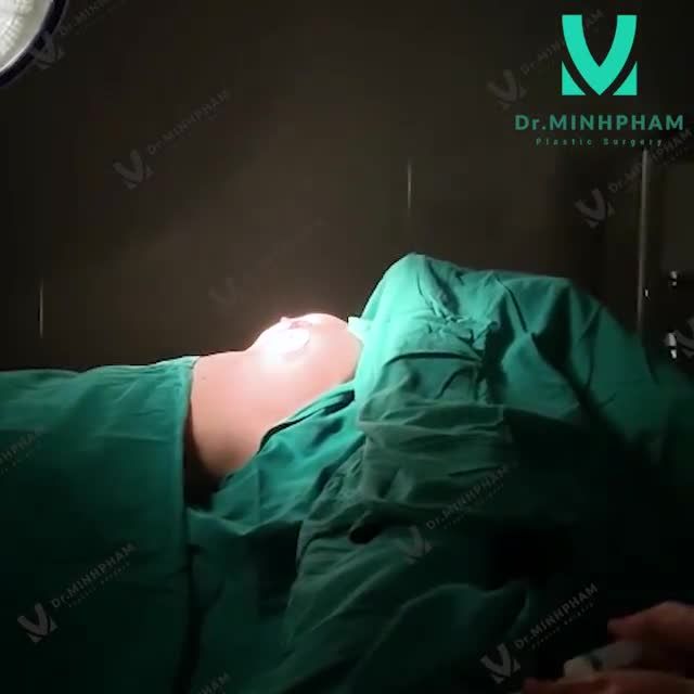 TREO SA TRỄ LẤY LẠI TỰ TIN CHO PHỤ NỮ SAU SINH
