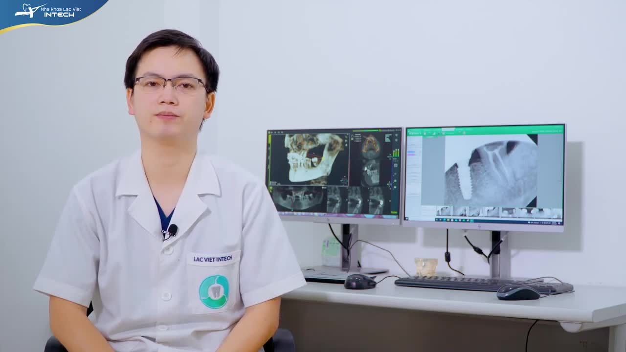 TRỒNG RĂNG IMPLANT TOÀN HÀM ALL-ON-6 - KHÔI PHỤC HÀM RĂNG TRÊN CHO KHÁCH HÀNG 61 TUỔI
