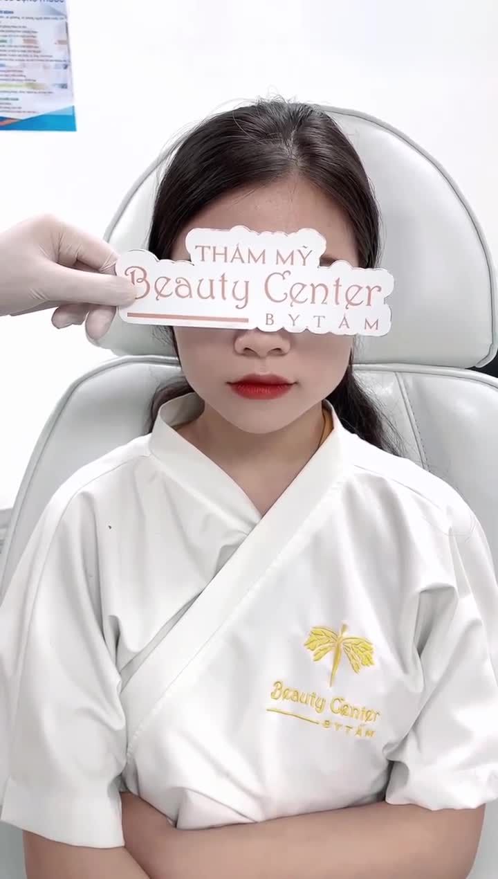 Trực tiếp Botox thon gọn hàm cho khách hành hàm bạnh to, mặt lệch do ăn nhai và nằm sai tư thế lâu ngày.