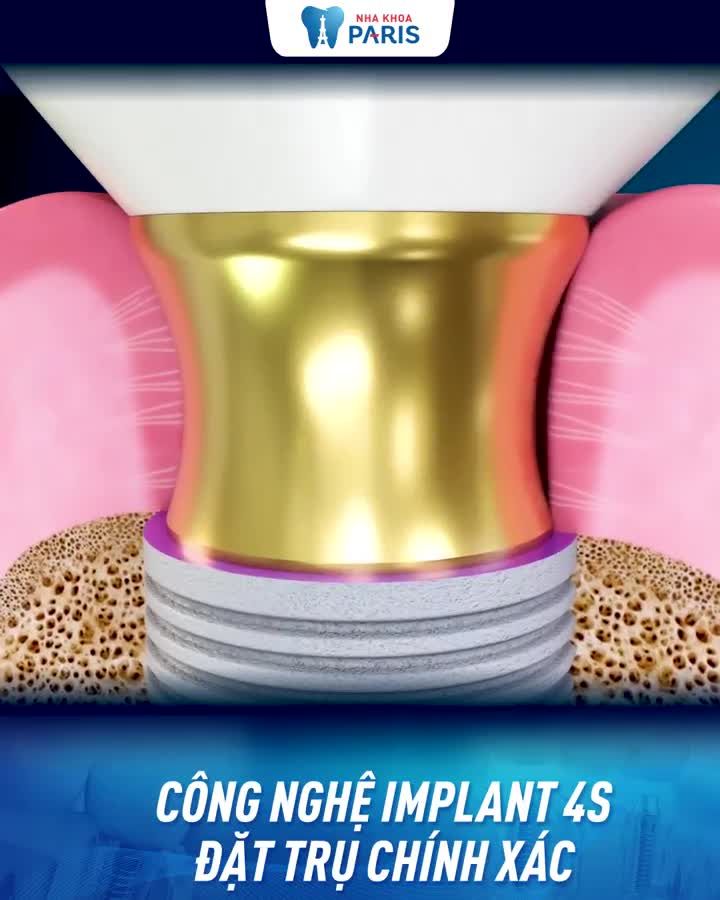 TS. BS Trâm 20 năm kinh nghiệm tư vấn miễn phí