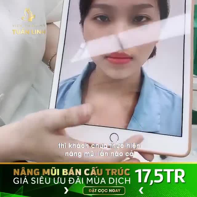 Từ chiếc mũi thấp tẹt, không có điểm nhấn,dưới bàn tay bác sĩ nhà Tuấn Linh "biến hóa" thần kỳ
