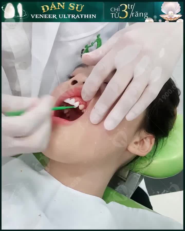 VIỆC CỦA BẠN NGAY LÚC NÀY LÀ LÀM ĐẸP CHO NỤ CƯỜI