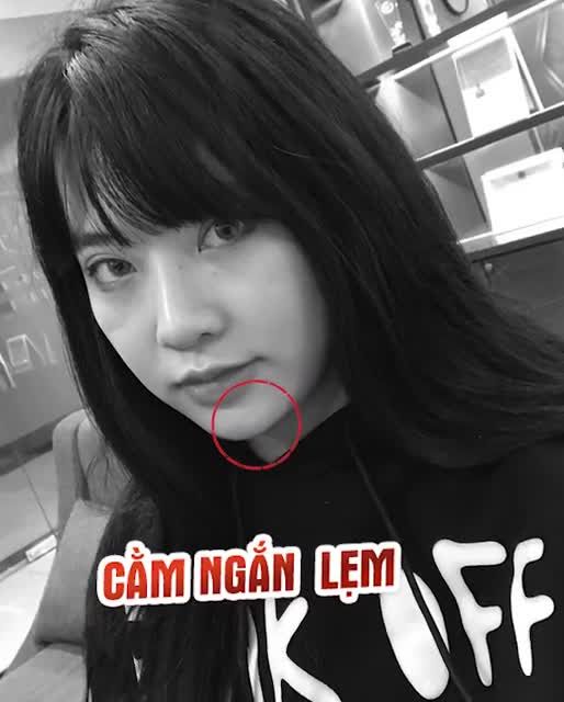 Xinh đẹp tựa nàng thơ với Độn cằm V-line tại Dr.Hải Lê