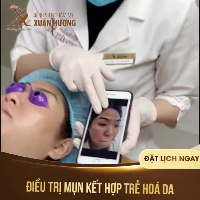 "THAY MỚI" LÀN DA ĐẦY BẤT NGỜ SAU LIỆU TRÌNH TRỊ MỤN KẾT HỢP TRẺ HÓA DA