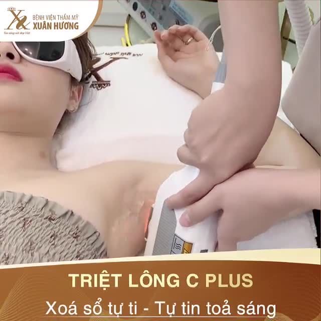 Triệt lông nách 6 lần ở nơi khác vẫn chưa hết