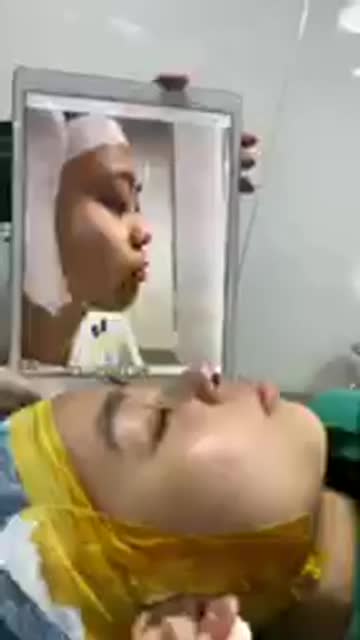 CA NÂNG MŨI THỨ 2 TRONG NGÀY. LÀM ĐẸP ĐÓN TẾT CÙNG DR NGỌC TRUNG NGAY HÔM NAY NHÉ!